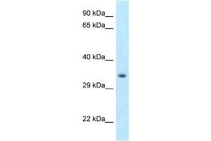 Image no. 1 for anti-Homeobox C11 (HOXC11) (C-Term) antibody (ABIN2780910)