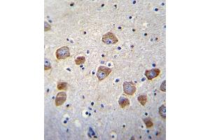 Immunohistochemistry (IHC) image for anti-Dopamine beta-Hydroxylase (Dopamine beta-Monooxygenase) (DBH) (N-Term) antibody (ABIN2160499)