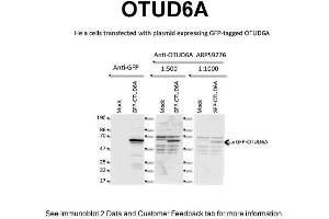 Image no. 3 for anti-OTU Domain Containing 6A (OTUD6A) (N-Term) antibody (ABIN2774251)