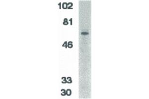 Image no. 1 for anti-Interleukin-1 Receptor-Associated Kinase 2 (IRAK2) (C-Term) antibody (ABIN6655355)