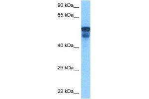 Image no. 5 for anti-Porcupine Homolog (PORCN) (N-Term) antibody (ABIN2783888)