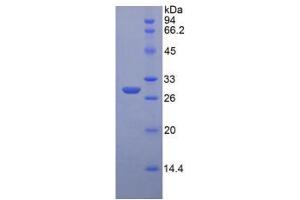 Image no. 1 for Insulin-Like Growth Factor 2 Receptor (IGF2R) protein (ABIN3009980)