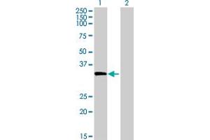 Image no. 1 for anti-Ankyrin Repeat and SOCS Box Containing 4 (ASB4) (AA 1-349) antibody (ABIN526853)