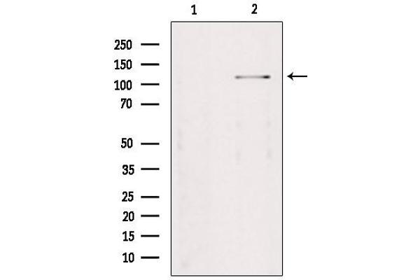 anti-TAO Kinase 2 (TAOK2) (Internal Region) antibody
