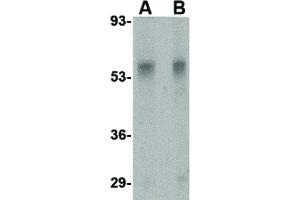 Image no. 1 for anti-Plexin Domain Containing 1 (PLXDC1) (Internal Region) antibody (ABIN6656325)