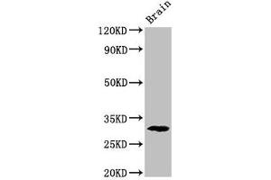 PDXP Antikörper  (AA 1-292)