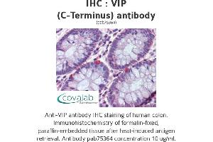 Image no. 2 for anti-Vasoactive Intestinal Peptide (Vip) (C-Term) antibody (ABIN5693743)