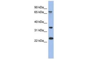 Image no. 1 for anti-TBC1 Domain Family, Member 25 (TBC1D25) (AA 179-228) antibody (ABIN6744062)