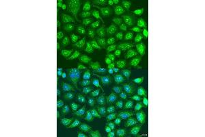 Image no. 1 for anti-Spindle and Centriole Associated Protein 1 (SPICE1) antibody (ABIN6148351)