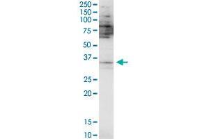Image no. 1 for anti-Proximal Sequence Element 1 (SPDEF) (AA 1-335) antibody (ABIN565168)