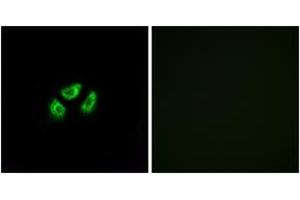Image no. 1 for anti-Sodium Channel, Voltage-Gated, Type VII, alpha Subunit (SCN7A) (AA 771-820) antibody (ABIN1535377)