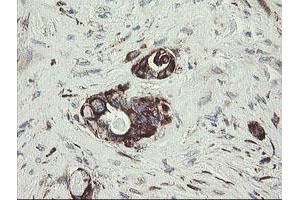 Image no. 5 for anti-Tumor Protein D52-Like 3 (TPD52L3) antibody (ABIN1501475)
