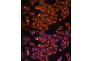 Merlin antibody  (AA 477-576)