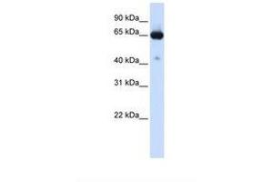 Image no. 1 for anti-Solute Carrier Family 39 (Zinc Transporter), Member 4 (SLC39A4) (AA 38-87) antibody (ABIN6738103)