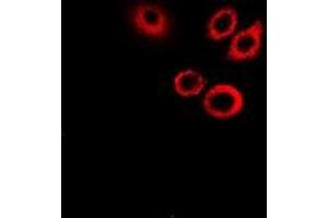 Image no. 1 for anti-serpin Peptidase Inhibitor, Clade B (Ovalbumin), Member 1 (SERPINB1) (full length) antibody (ABIN6005302)