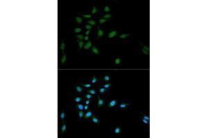 Image no. 4 for anti-Proteasome Subunit alpha Type 1 (PSMA1) antibody (ABIN3016184)