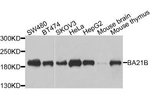 BAZ1B antibody  (AA 1-260)