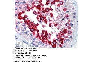 Image no. 2 for anti-JAZF Zinc Finger 1 (JAZF1) (C-Term) antibody (ABIN2778568)