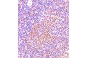 Image no. 2 for anti-TRAF Family Member-Associated NFKB Activator (TANK) (C-Term) antibody (ABIN500867)