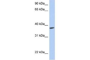 anti-Rhabdoid Tumor Deletion Region Gene 1 (RTDR1) (Middle Region) antibody
