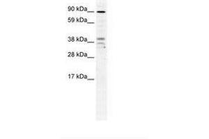 Image no. 1 for anti-Zinc Finger CCCH-Type Containing 7B (ZC3H7B) (AA 136-185) antibody (ABIN202958)