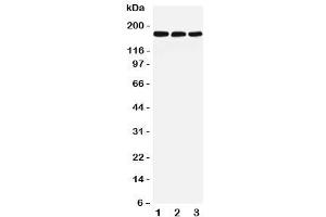 Image no. 2 for anti-Low Density Lipoprotein Receptor-Related Protein 5 (LRP5) (C-Term) antibody (ABIN3031640)