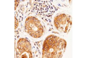 Image no. 3 for anti-Melanoma Associated Chondroitin Sulfate Proteoglycan (MCSP) (AA 950-1000), (Extracellular Domain) antibody (ABIN571645)