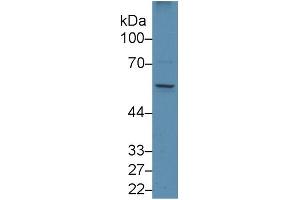Image no. 3 for Early Growth Response 1 (EGR1) ELISA Kit (ABIN6730895)