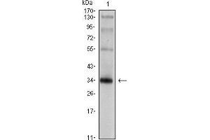 Image no. 2 for anti-Synaptophysin (SYP) antibody (ABIN969428)