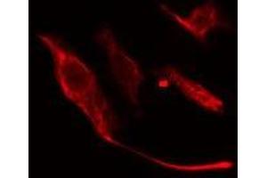 Image no. 1 for anti-Vesicle Transport through Interaction with t-SNAREs 1A (VTI1A) (Internal Region) antibody (ABIN6258471)