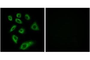 Image no. 2 for anti-Cytochrome P450, Family 2, Subfamily W, Polypeptide 1 (CYP2W1) (AA 311-360) antibody (ABIN1534393)