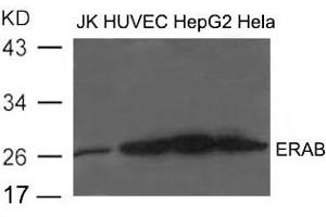 Image no. 1 for anti-Hydroxysteroid (17-Beta) Dehydrogenase 10 (HSD17B10) (AA 253-527) antibody (ABIN6267742)