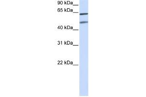 Image no. 1 for anti-Optineurin (OPTN) (N-Term) antibody (ABIN2779546)