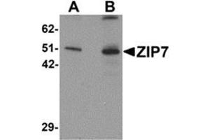 Image no. 1 for anti-Solute Carrier Family 39 (Zinc Transporter), Member 7 (SLC39A7) (N-Term) antibody (ABIN783807)