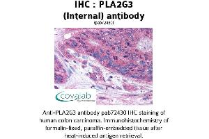 Image no. 1 for anti-Phospholipase A2, Group III (PLA2G3) (Internal Region) antibody (ABIN1738135)