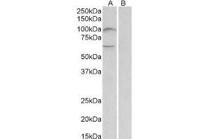 Image no. 1 for anti-Netrin receptor UNC5B (UNC5B) (AA 629-643) antibody (ABIN1781816)