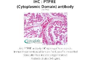 Image no. 1 for anti-Protein tyrosine Phosphatase, Receptor Type, E (PTPRE) (Cytoplasmic Domain) antibody (ABIN1738605)