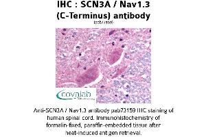 Image no. 1 for anti-Sodium Channel, Voltage-Gated, Type III, alpha Subunit (SCN3A) (C-Term) antibody (ABIN1739060)