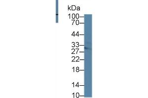 Image no. 1 for anti-Methylthioadenosine phosphorylase (MTAP) (AA 6-275) antibody (ABIN1869297)