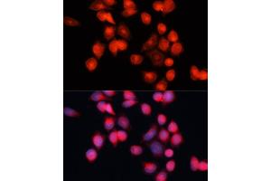 Immunofluorescence analysis of HeLa cells using SLC25 antibody (ABIN7270430) at dilution of 1:100 (40x lens).