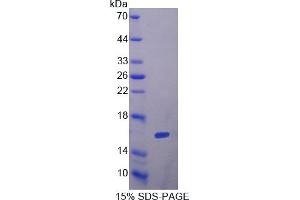 Image no. 1 for Follicle Stimulating Hormone, beta Polypeptide (FSHB) (AA 21-130) protein (His tag) (ABIN6239992)