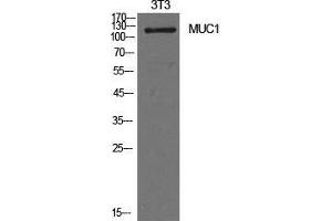 Image no. 2 for anti-Mucin 1 (MUC1) (Internal Region) antibody (ABIN3181456)
