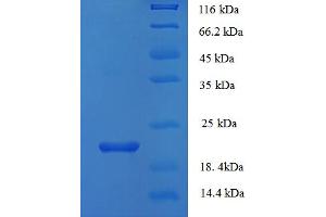 Image no. 1 for phospholipase A2 Receptor 1, 180kDa (PLA2R1) (AA 395-530), (partial) protein (His tag) (ABIN5711323)