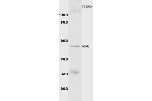 Image no. 1 for anti-Myostatin (MSTN) (AA 281-375) antibody (ABIN674469)