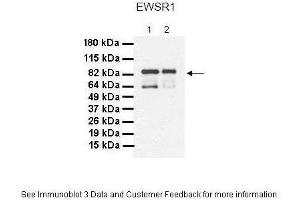 Image no. 3 for anti-Ewing Sarcoma Breakpoint Region 1 (EWSR1) (Middle Region) antibody (ABIN2779045)