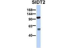 Image no. 3 for anti-SID1 Transmembrane Family, Member 2 (SIDT2) (N-Term) antibody (ABIN2778621)