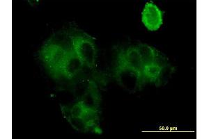 anti-Grancalcin, EF-Hand Calcium Binding Protein (GCA) (AA 1-217) antibody