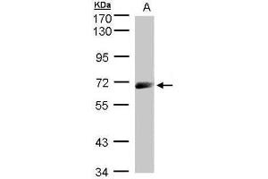 Image no. 1 for anti-Interleukin 12 Receptor beta 1 (IL12RB1) (Center) antibody (ABIN2854451)