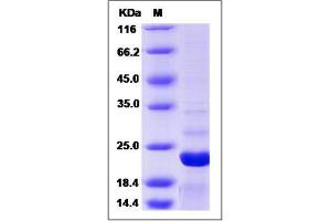 Image no. 1 for ADP-Ribosylation Factor 3 (ARF3) (AA 1-181) protein (His tag) (ABIN2006378)