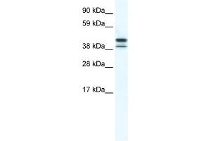 WB Suggested Anti-TRF3 Antibody Titration:  5.